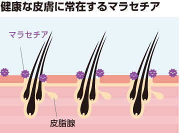 健康な皮膚に常在するマラセチア